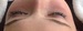 image.jpg 3. PO APLIKACI TRVALÉ